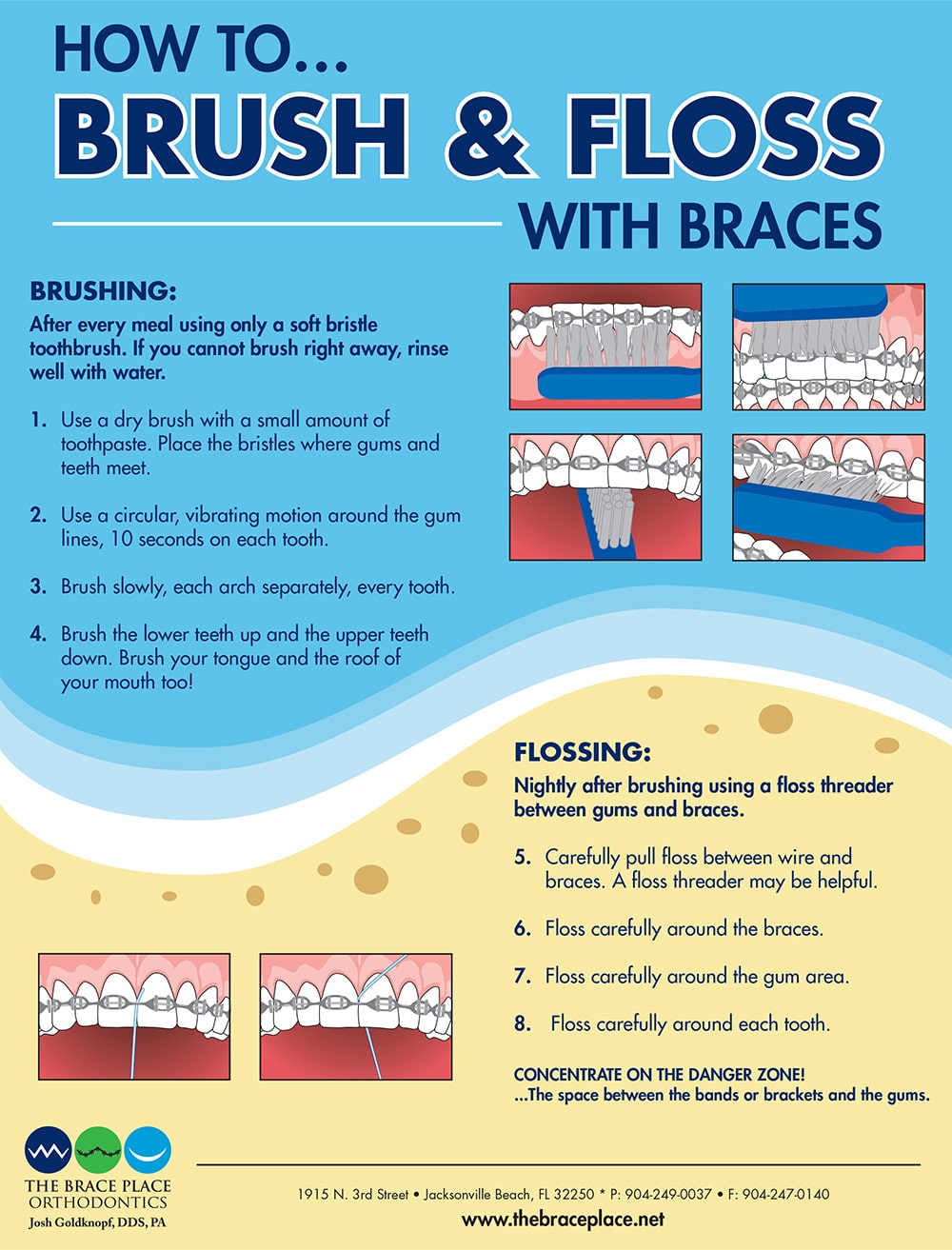 Flossing Techniques for Braces: A Step-by-Step Guide