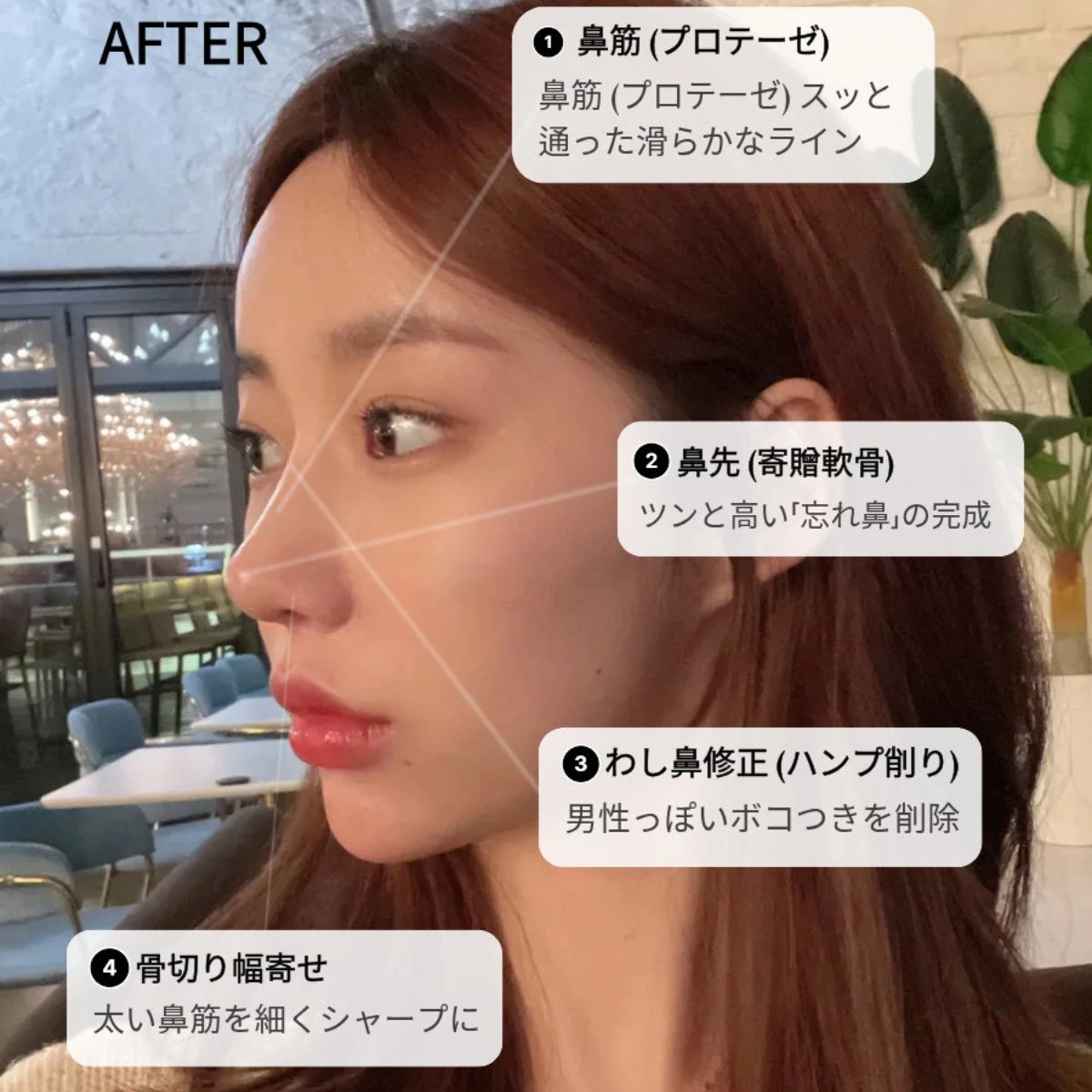 ティアナ整形外科ㅣ1:1 医師相談