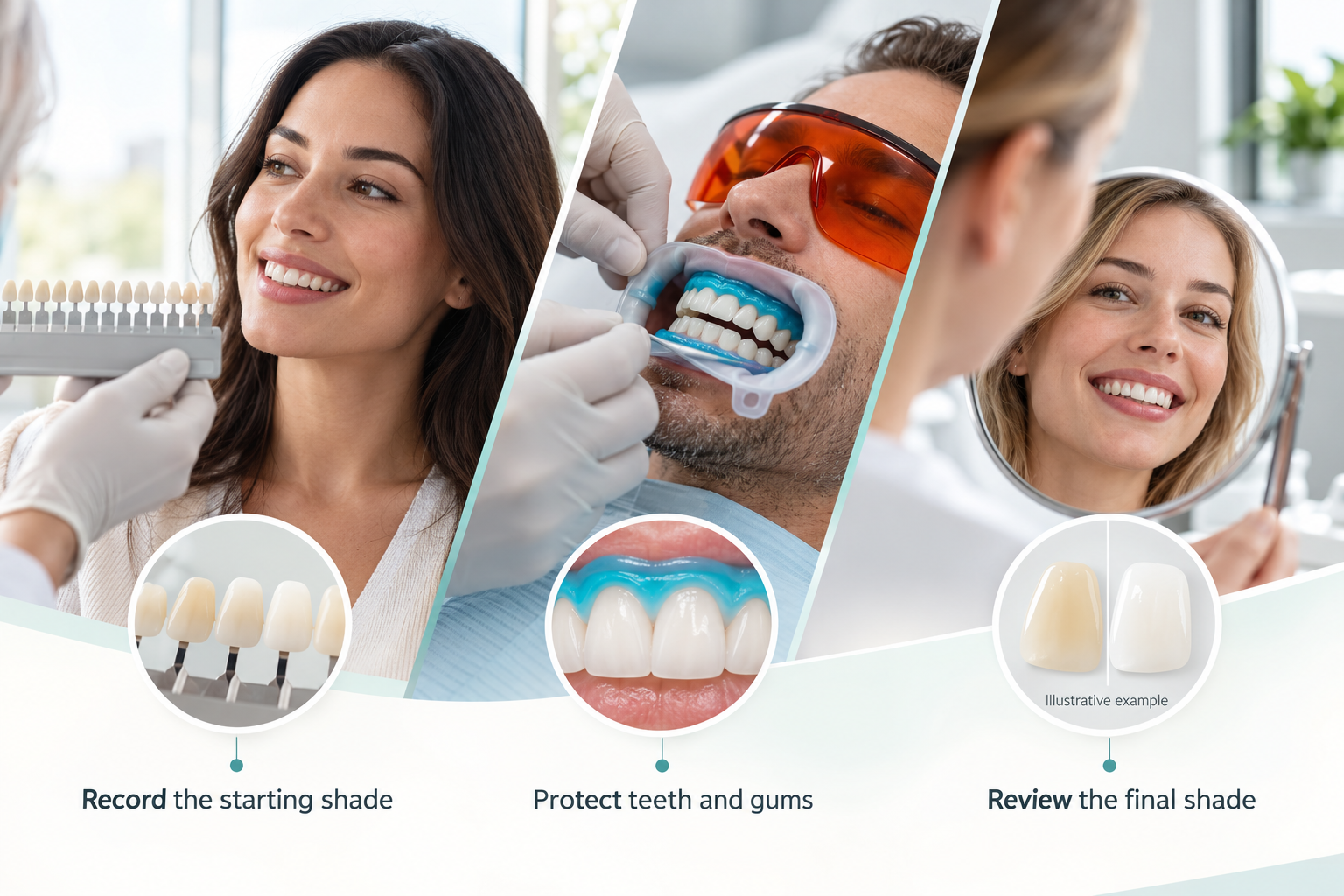 Infographic: How the Treatment Works. Record the starting shade. Protect teeth and gums. Review the final shade