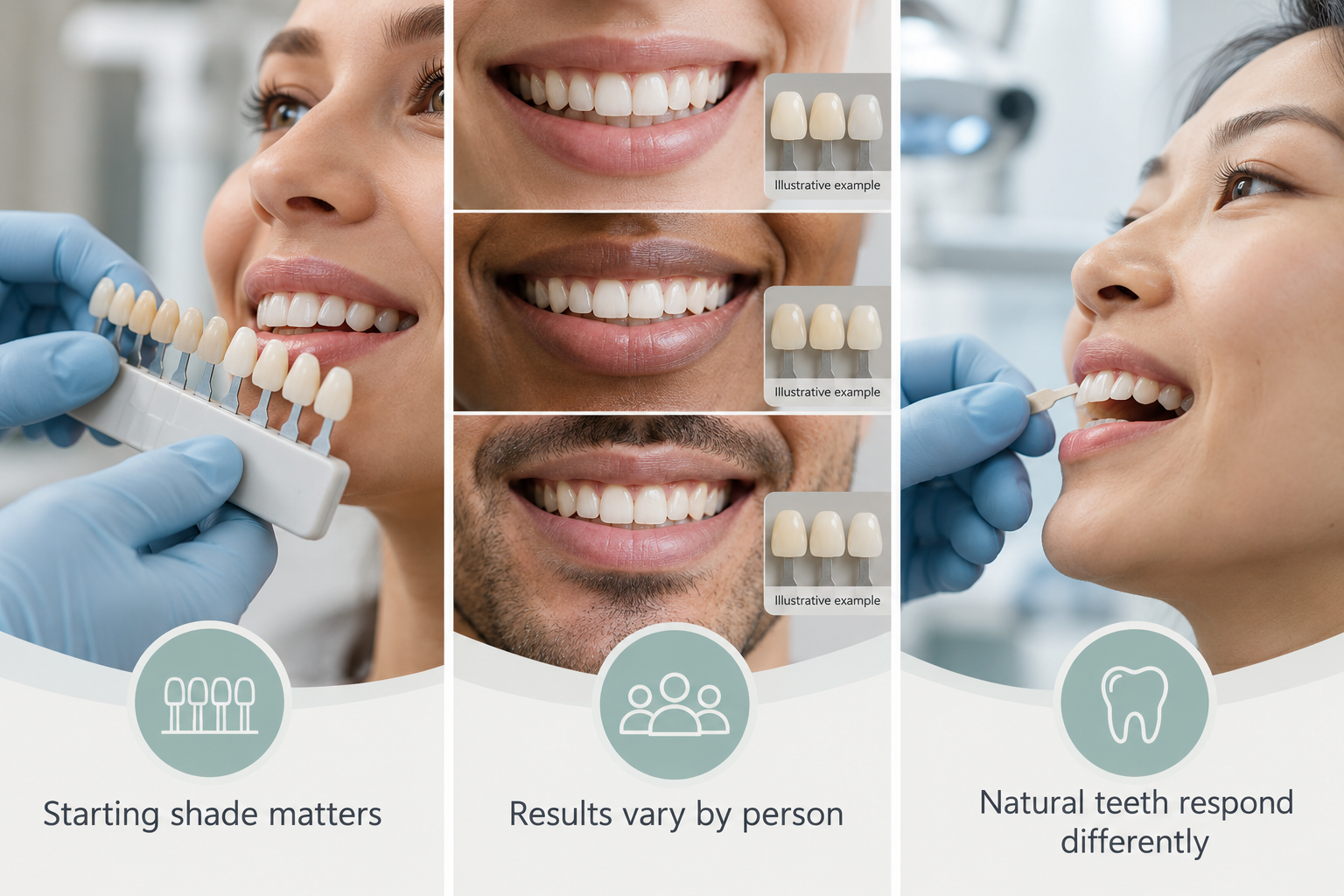Infographic: Realistic Results and Expectations. Starting shade matters. Results vary by person. Natural teeth respond differently