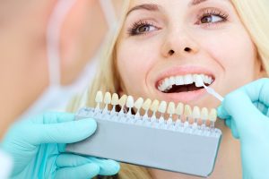 Teeth Whitening 101: Methods, Costs, and Safety