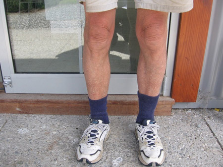 Bob's knees